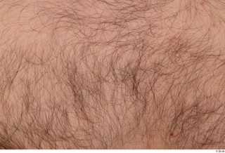 Turgen hairy nude skin 0002.jpg